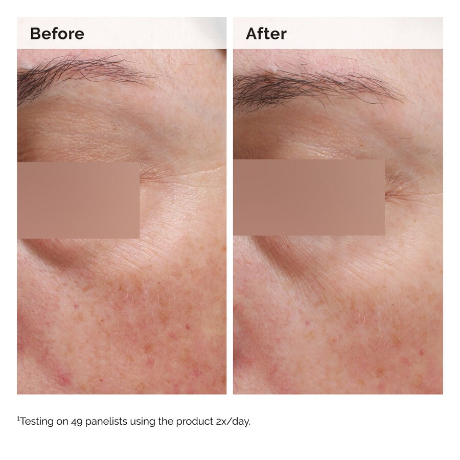 Niacinamide 5% Face and Body Emulsion - US 6064