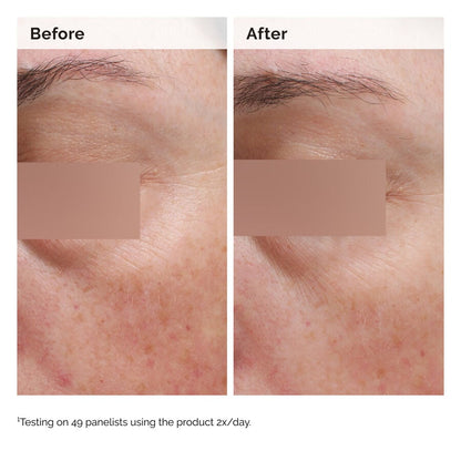 Niacinamide 5% Face and Body Emulsion - US 6064