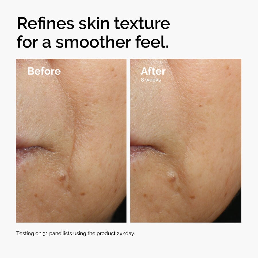 Caffeine 3% + Escin 1% Face Serum - US 7002