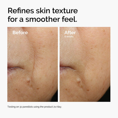 Caffeine 3% + Escin 1% Face Serum - US 7002