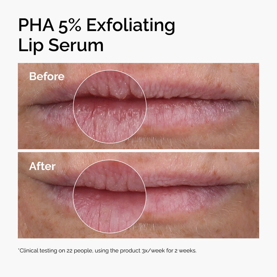 PHA 5% Exfoliating Lip Serum - US 1823