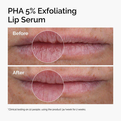PHA 5% Exfoliating Lip Serum - US 1823